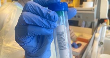 Corona-Test Kanaren Kanarische Inseln Covid-19 PCR-Test