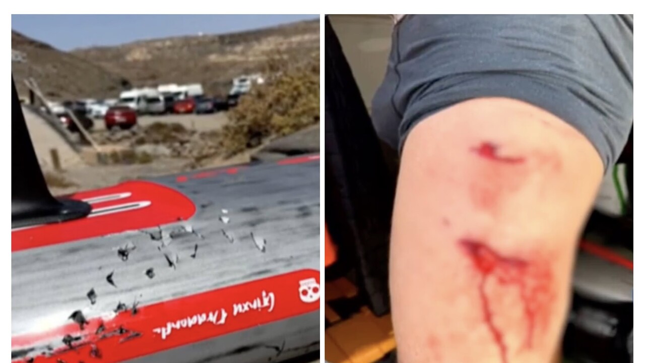 Hai-Attacke auf Fuerteventura – Surfer überlebt Biss