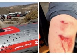 Hai-Attacke auf Fuerteventura – Surfer überlebt Biss