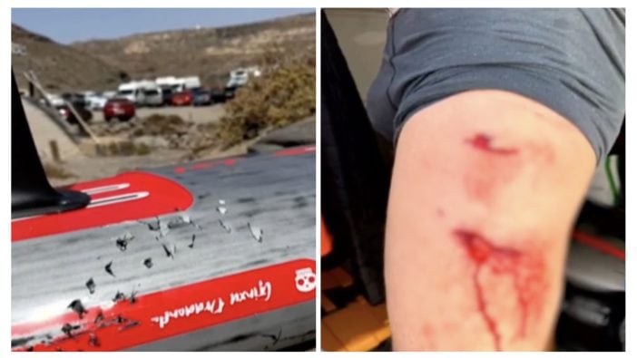 Hai-Angriff Fuerteventura